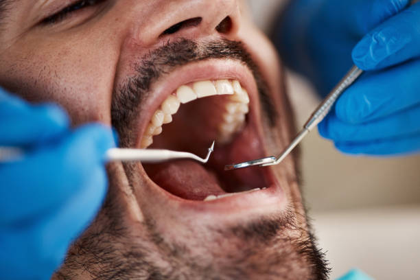 Best Emergency Treatment for Oral Infections in Claryville, KY